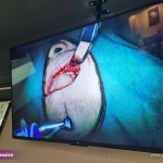 4-C-Tech-Implant-Sinus-lift-course-_-Shanghai