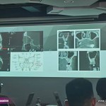 5-C-Tech-Implant-Sinus-lift-course-_-Shanghai