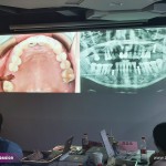 8-C-Tech-Implant-Sinus-lift-course-_-Shanghai