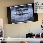 c-tech-implant-Plandent-training-trip-to-Bologna-14-16-february-2020-02