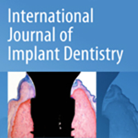 International-Journal-of-Implant-Dentistry