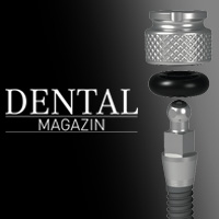 dental-magazin-october-2014-minis-mini-dental-implant-acceptance-is-growing-teaser