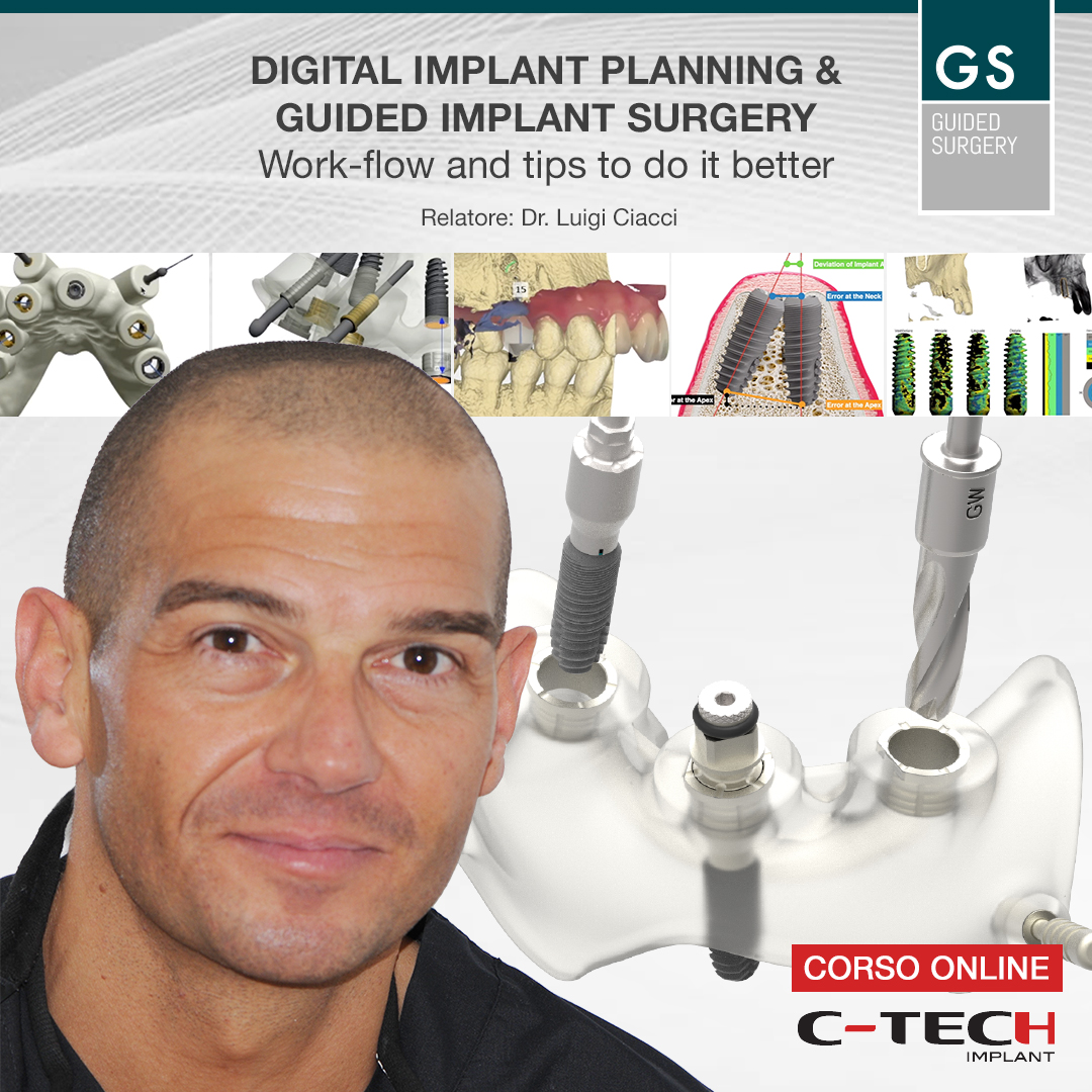 webinar-Digital-implant-planning-&-guided-implant-surgery-Work-flow-and-tips-to-do-it-better-Dr-Luigi-Ciacci